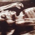 Ultrasonda, hem bebek hem de dinazor görüntüsü şaşkına çevirdi