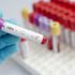 Yaklaşık 300 milyon kişi hepatitle yaşadığından habersiz