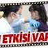 Türkiye'de ilk aşı denemesi yapıldı! Koronavirüs aşısının yan etkileri var mı?
