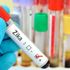 Zika Virüs nedir