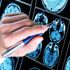 Pandemide epilepsi hastaları risk altında mı? Pandemide epilepsi hastaları risk altında mı?