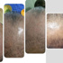 Sa� d�k�lmesine nanoteknoloji ile ��z�m