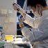 Hematoloji ve onkoloji tanısında 'yapay zeka' rol oynayacak