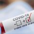 Covid-19’da belirti göstermeyen taşıyıcılar büyük risk altında