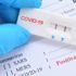Evde korona testi yapılıyor mu? Evde test covid-19 testi nasıl yapılır? Evde korona testi yapılıyor mu? Evde test covid-19 testi nasıl yapılır?