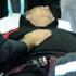 Eriş'in tedavisi devam ediyor