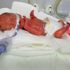 Dünyaya 285 gram olarak mucizeye imza attı Dünyaya 285 gram olarak mucizeye imza attı