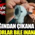 Kadının kulağından çıkan doktorları şaşkına çevirdi Kadının kulağından çıkan doktorları şaşkına çevirdi
