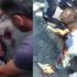 Esenyurt'taki dehşet anları: Küçük çocuk beyin kanaması geçirmiş