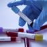 Avustralya'da koronavirüsten dolayı 3 kişi daha öldü