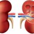 Şekerli içecekler kronik böbrek hastalığına neden oluyor