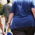 Obezite nedir? Şişmanlık nedenleri ve şişmanlık tedavisi Obezite nedir? Şişmanlık nedenleri ve şişmanlık tedavisi