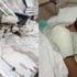Balık tutmak için hazırladığı düzenek, elinde patladı