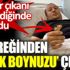 ﻿Böbreğinden geyik boynuzu çıktı