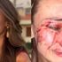 Ukraynalı model Daria Kyryliuk'e Çeşme'de saldırı! Bakan Ersoy tepki gösterdi