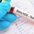 Beta HCG hormonu nedir? Beta HCG yüksekliği ve düşüklüğü ne anlama gelir? Beta HCG hormonu nedir? Beta HCG yüksekliği ve düşüklüğü ne anlama gelir?