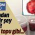 Kilo aldığını sayoyordu ama karnından futbol topu büyüklüğünde ur çıktı