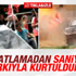 Suruç'taki patlamadan son anda kurtulan iki kişi - İZLE