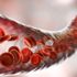Hemofili nedir? Hemofili nedenleri, belirtileri ve tedavisi… Hemofili nedir? Hemofili nedenleri, belirtileri ve tedavisi…