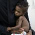 İnsani kriz hiç bu kadar kötüye gitmemişti... BM'den Yemen'de kıtlık uyarısı