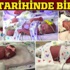 ABD'de tarihinde ilk beşiz kız bebek