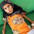Yemenli kız bir deri bir kemik kaldı