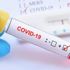 Uzman Psikolog Malas: "Covid-19 şiddeti artırdı" Uzman Psikolog Malas: "Covid-19 şiddeti artırdı"