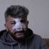 'Allah annesine sabır versin' dedi, gerçeği öğrenince inanamadı! 'Allah annesine sabır versin' dedi, gerçeği öğrenince inanamadı!