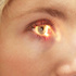 Diyabetik retinopati kör yapabilir