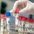 Ege Üniversitesi Kovid-19 PCR testi için yetkilendirildi Ege Üniversitesi Kovid-19 PCR testi için yetkilendirildi