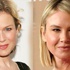 Renee Zellweger'in son hali görenleri şaşırttı!