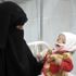 'Yemen'de dünyanın en büyük insani krizi yaşanıyor'