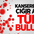 Kansere Karşı Türk Buluşu Kansere Karşı Türk Buluşu