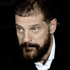 Bilic'ten o iddiaya cevap! Bilic'ten o iddiaya cevap!