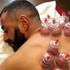 Karim Benzema hacamat yaptırdı