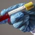 KKTC'de koronavirüs nedeniyle 3'üncü ölüm