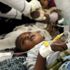 Yemen'de 150 bin çocukta şüpheli kolera vakası tespit edildi