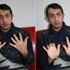 Askerde parmakları ezildi, 6 yıldır hayatı karardı Askerde parmakları ezildi, 6 yıldır hayatı karardı