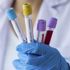 Lancet: Covid geçirenler yeniden enfekte olabilir Lancet: Covid geçirenler yeniden enfekte olabilir