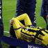 Fenerbahçe'de Mesut Özil, Antalyaspor maçında sakatlanarak sedyeyle oyun alanını terk etti Fenerbahçe'de Mesut Özil, Antalyaspor maçında sakatlanarak sedyeyle oyun alanını terk etti