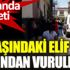 ﻿Maganda dehşeti. 12 yaşındaki Elif başından vuruldu