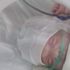 Mucize bebek Rojin'in ambulans yangınında kahreden ölümü Mucize bebek Rojin'in ambulans yangınında kahreden ölümü