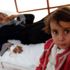 UNICEF: Koronavirüs salgınında yardımın azalması, milyonlarca Yemenli çocuğu riske atıyor UNICEF: Koronavirüs salgınında yardımın azalması, milyonlarca Yemenli çocuğu riske atıyor