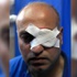 İsrail askerleri foto muhabirini yaraladı İsrail askerleri foto muhabirini yaraladı
