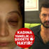 Eski eşinin şiddetine maruz kalan kadın: Can güvenliğim yok!