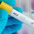 Hepatit yılda 1,5 milyon can alıyor