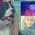 Polis saldırgan Pitbull'u vurdu