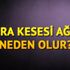 Safra kesesi ağrısı neden olur? Safra kesesi taşı ... Safra kesesi ağrısı neden olur? Safra kesesi taşı ...