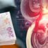 Organ ticaretine 5 tutuklama