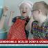 Down sendromlu ikizler dünya gündeminde! Umut oldular |Video